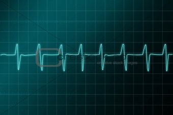Cardiogram ritm
