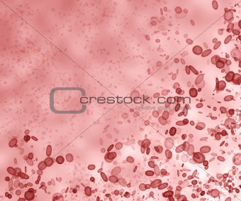 Cluttering of red blood cells