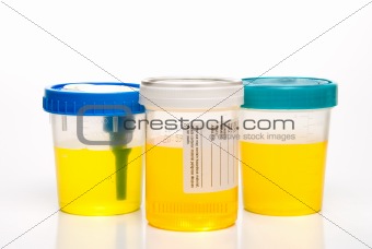 Urine Samples