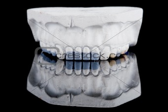 human teeth, model 