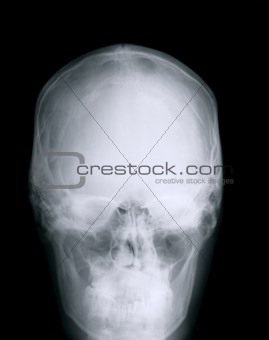 X-ray Head
