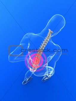 backache illustration
