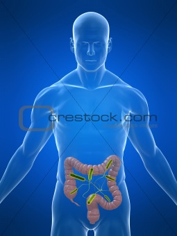 colon infection