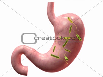 stomach infection