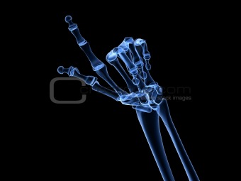 x-ray hand - arthritis