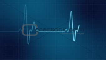 EKG heart monitor 