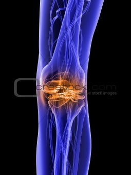 painful knee