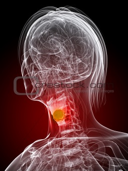 highlighted larynx