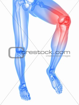 painful knee illustration