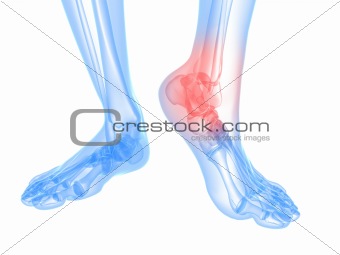 painful ankle illustration