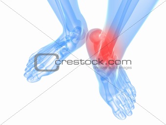 painful ankle illustration