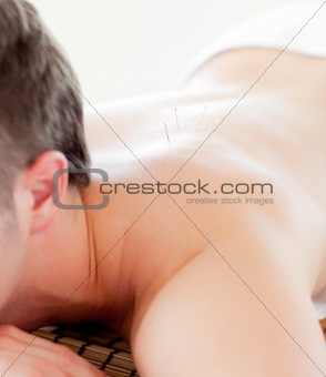Close-up of a caucasian man receiving a acupuncture treatment 