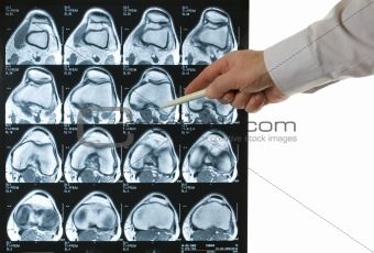 MRI of knee top doc