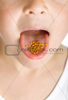 Pollen granules on child tongue