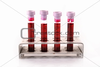 Medical test tubes with blood in holder on white background 