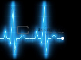 Electrocardiogram. EPS 8
