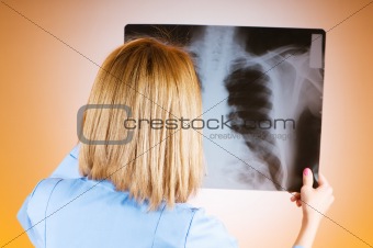 Female doctor carefully x-ray of patient