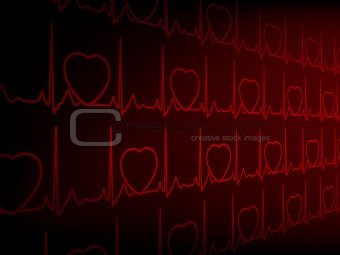 Cardiogram EKG. EPS 8