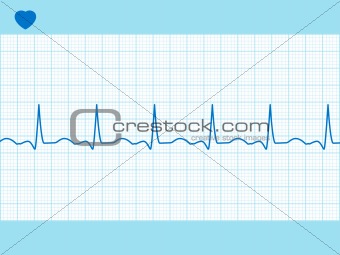 Heart cardiogram fully editable. EPS 8