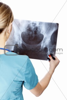 Female doctor examining an x-ray image.