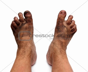 dirty unhygienic feet