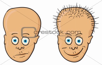 Vector illustration - patient with a bald head and hair