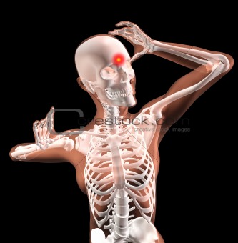Female medical skeleton with migraine