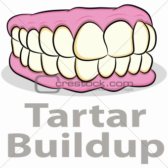 Tartar Buildup on Teeth