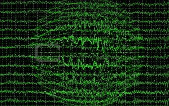 brain wave encephalogramme EEG isolated on black background