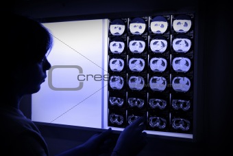 Doctor in surgical scrubs looking x-ray