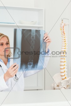 Sad looking doctor holding x-ray looking at it 