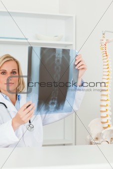 Sad looking doctor holding x-ray looking into camera