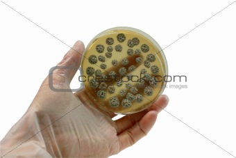 microorganisms on the plate