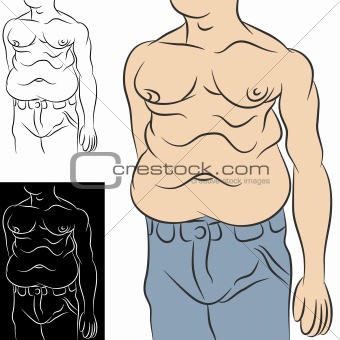 Man With Abdominal Fat