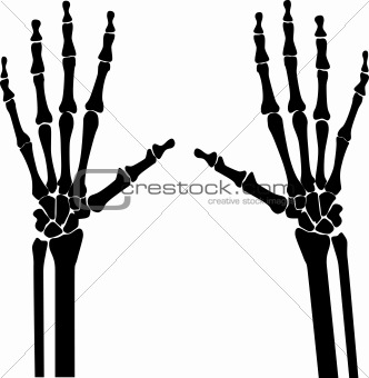 x-ray_hands