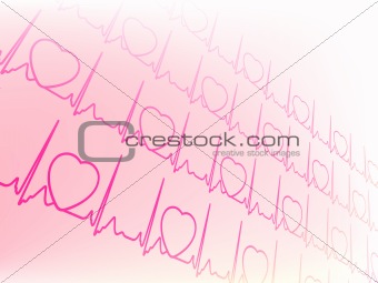 electrocardiogram, waveform from EKG test 