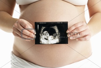 Detail Of Pregnant Woman Holding Ultrasound Scan