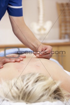 Acupuncturist treating female client