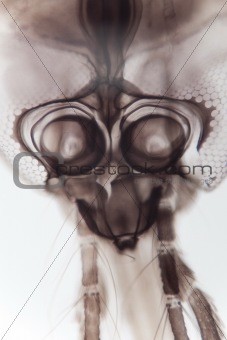 Mosquito Head Under Microscope