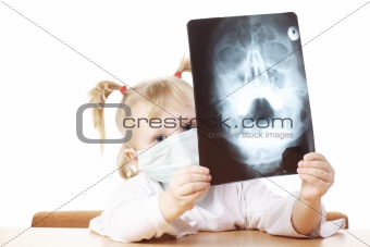 child playing with X-ray photograph