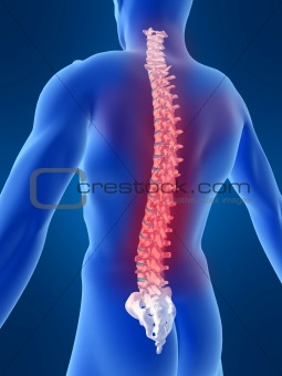 backache illustration