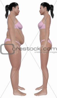 Weight Loss Before And After Side View
