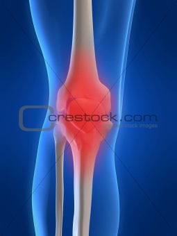 human painful knee