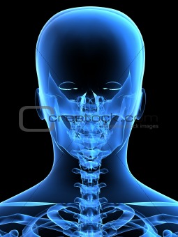 x-ray head from the back