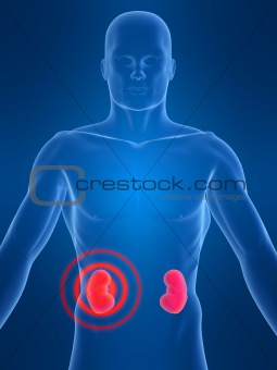 kidney inflammation