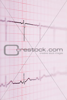 ECG graph
