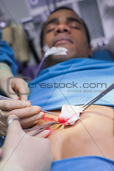 Close up of a patient having a surgery