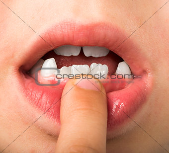 Child shows tooth