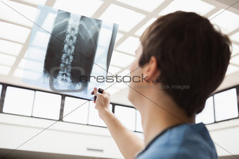Nurse is checking an x-ray