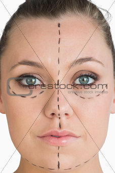 Woman ready to get face lift